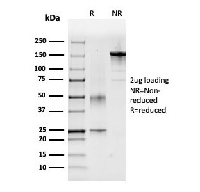SDS-PAGE analysis of purified, BSA-free Factor VII antibody as confirmation of integrity and purity.