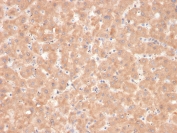 IHC staining of FFPE human liver with Factor VII antibody. HIER: boil tissue sections in pH 9 10mM Tris with 1mM EDTA for 20 min and allow to cool before testing.