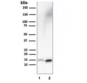Western blot testing of human 1) HepG2 and 2) kidney lysate with FABP1 antibody. Predicted molecular weight: ~14 kDa.