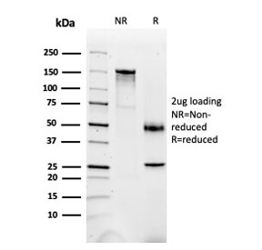 SDS-PAGE analysis of purified, BSA-free FABP1 antibody as confirmation of integrity and purity.