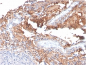 IHC staining of FFPE human tonsil with Fibronectin antibody (clone C6F10). HIER: boil tissue sections in pH 9 10mM Tris with 1mM EDTA for 20 min and allow to cool before testing.