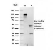 SDS-PAGE analysis of purified, BSA-free FABP1 antibody as confirmation of integrity and purity.