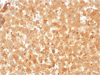 IHC staining of FFPE human liver with A2M antibody. HIER: boil tissue sections in pH 9 10mM Tris with 1mM EDTA for 20 min and allow to cool before testing.