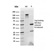 SDS-PAGE analysis of purified, BSA-free A2M antibody as confirmation of integrity and purity.