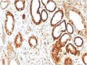 IHC staining of FFPE human kidney with FABP1 antibody. HIER: boil tissue sections in pH 9 10mM Tris with 1mM EDTA for 20 min and allow to cool before testing.