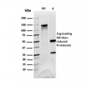 SDS-PAGE analysis of purified, BSA-free FABP1 antibody as confirmation of integrity and purity.