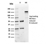 SDS-PAGE analysis of purified, BSA-free FABP1 antibody as confirmation of integrity and purity.