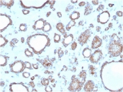 IHC staining of FFPE human thyroid with DBC2 antibody. HIER: boil tissue sections in pH 9 10mM Tris with 1mM EDTA for 20 min and allow to cool before testing.