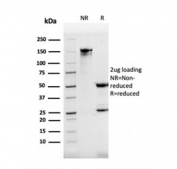 SDS-PAGE analysis of purified, BSA-free DBC2 antibody as confirmation of integrity and purity.