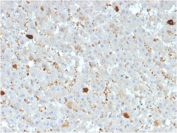 IHC staining of FFPE human liver with APOAIV antibody. HIER: boil tissue sections in pH 9 10mM Tris with 1mM EDTA for 20 min and allow to cool before testing.