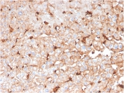 IHC staining of FFPE human liver with APOD antibody. HIER: boil tissue sections in pH 9 10mM Tris with 1mM EDTA for 20 min and allow to cool before testing.