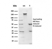 SDS-PAGE analysis of purified, BSA-free APOD antibody as confirmation of integrity and purity.