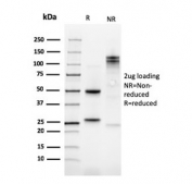 SDS-PAGE analysis of purified, BSA-free Kindlin-1 antibody (clone 4A5.14) as confirmation of integrity and purity.