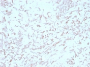 IHC staining of FFPE human liver with Kindlin-1 antibody (clone 4A5.14). HIER: boil tissue sections in pH 9 10mM Tris with 1mM EDTA for 20 min and allow to cool before testing.