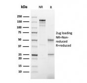 SDS-PAGE analysis of purified, BSA-free Thyroid Peroxidase antibody as confirmation of integrity and purity.
