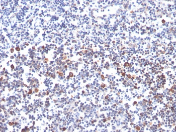 IHC staining of FFPE human tonsil with OX40 antibody. HIER: boil tissue sections in pH 9 10mM Tris with 1mM EDTA for 20 min and allow to cool before testing.