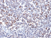 IHC staining of FFPE human tonsil with OX40 antibody. HIER: boil tissue sections in pH 9 10mM Tris with 1mM EDTA for 20 min and allow to cool before testing.