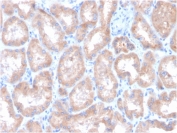 IHC staining of FFPE human kidney with Carbonic Anhydrase IX antibody. HIER: boil tissue sections in pH 9 10mM Tris with 1mM EDTA for 20 min and allow to cool before testing.