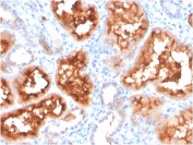 IHC staining of FFPE human kidney with Carbonic Anhydrase IX antibody. HIER: boil tissue sections in pH 9 10mM Tris with 1mM EDTA for 20 min and allow to cool before testing.