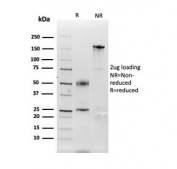 SDS-PAGE analysis of purified, BSA-free Carbonic Anhydrase IX antibody as confirmation of integrity and purity.