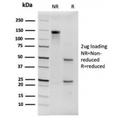 SDS-PAGE analysis of purified, BSA-free Histidine antibody (clone 6HIS/3550) as confirmation of integrity and purity.