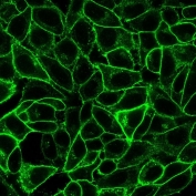 Immunofluorescent staining of PFA-fixed human HeLa cells with Endoglin antibody (clone ENG/1621).