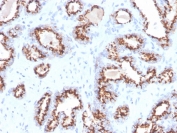 IHC staining of FFPE human prostate with recombinant Prostein antibody (clone ZR9). HIER: boil tissue sections in pH 9 10mM Tris with 1mM EDTA for 20 min and allow to cool before testing.