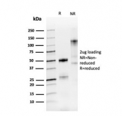 SDS-PAGE analysis of purified, BSA-free recombinant PAX8 antibody as confirmation of integrity and purity.