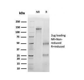 SDS-PAGE analysis of purified, BSA-free p16INK4a antibody (clone CDKN2A/4499) as confirmation of integrity and purity.