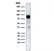 Western blot testing of human MCF7 cell lysate with HSP90AB1 antibody. Expected molecular weight: 84-90 kDa.
