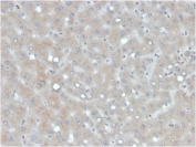 IHC staining of FFPE human liver with Apolipoprotein B antibody. HIER: boil tissue sections in pH 9 10mM Tris with 1mM EDTA for 20 min and allow to cool before testing.