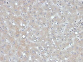 IHC staining of FFPE human liver with Apolipoprotein B antibody. HIER: boil tissue sections in pH 9 10mM Tris with 1mM EDTA for 20 min and allow to cool before testing.