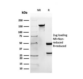 SDS-PAGE analysis of purified, BSA-free Apolipoprotein B antibody as confirmation of integrity and purity.