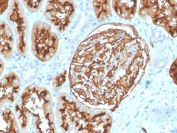 IHC staining of FFPE human kidney with CD10 antibody (clone MME/3739). HIER: boil tissue sections in pH 9 10mM Tris with 1mM EDTA for 20 min and allow to cool before testing.