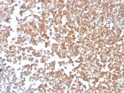IHC staining of FFPE human kidney with CD10 antibody (clone MME/3739). HIER: boil tissue sections in pH 9 10mM Tris with 1mM EDTA for 20 min and allow to cool before testing.