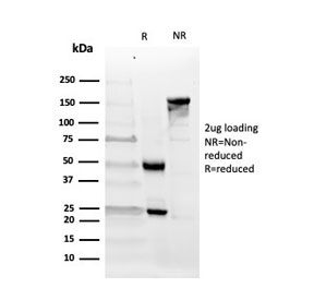 SDS-PAGE analysis of purified, BSA-free CD10 antibody (clone MME/4232) as confirmation of integrity and purity.