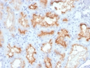 IHC staining of FFPE human kidney with CD10 antibody (clone MME/4233). HIER: boil tissue sections in pH 9 10mM Tris with 1mM EDTA for 20 min and allow to cool before testing.