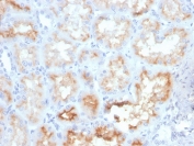 IHC staining of FFPE human kidney with CD10 antibody (clone MME/4233). HIER: boil tissue sections in pH 9 10mM Tris with 1mM EDTA for 20 min and allow to cool before testing.