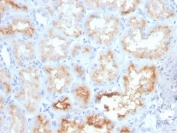 IHC staining of FFPE human kidney with CD10 antibody (clone MME/4233). HIER: boil tissue sections in pH 9 10mM Tris with 1mM EDTA for 20 min and allow to cool before testing.