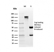 SDS-PAGE analysis of purified, BSA-free CD10 antibody (clone MME/4235) as confirmation of integrity and purity.