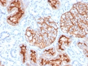 IHC staining of FFPE human kidney with CD10 antibody (clone MME/4235). HIER: boil tissue sections in pH 9 10mM Tris with 1mM EDTA for 20 min and allow to cool before testing.