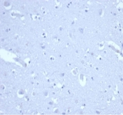 Negative control: IHC staining of FFPE human brain tissue with recombinant p21 antibody (clone CIP1/4377R). HIER: boil tissue sections in pH 9 10mM Tris with 1mM EDTA for 20 min and allow to cool before testing.