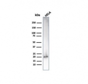 Western blot testing of human HeLa cell lysate with recombinant p21 antibody (clone CIP1/4377R).