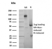SDS-PAGE analysis of purified, BSA-free recombinant p21 antibody (clone CIP1/4377R) as confirmation of integrity and purity.
