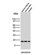 p21 Antibody Multi-Tissue WB. Western blot analysis of p21 / CDKN1A (Cyclin-dependent kinase inhibitor 1) expression across human tissue and cell line lysates using p21 antibody clone CIP1/4377R. Lane 1: human kidney lysate, Lane 2: human skin lysate, Lane 3: HepG2 cell lysate. A band is detected at approximately 21-24 kDa, consistent with the predicted molecular weight of p21 (CDKN1A), a key regulator of cell cycle arrest and checkpoint control. The presence of signal across multiple sample types reflects the broad expression of p21 in response to cellular stress and growth regulatory signals.
