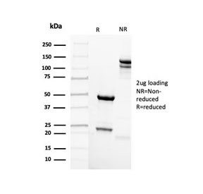 SDS-PAGE analysis of purified, BSA-free recombinant Mammaglobin antibody (clone rMGB/4299) as confirmation of integrity and purity.