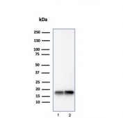 Western blot testing of human 1) JEG-3 and 2) LNCaP lysate with Superoxide Dismutase 1 antibody. Predicted molecular weight ~16 kDa.