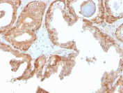 IHC staining of FFPE human prostate with Superoxide Dismutase 1 antibody. HIER: boil tissue sections in pH 9 10mM Tris with 1mM EDTA for 20 min and allow to cool before testing.