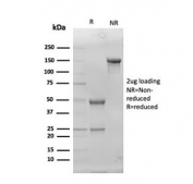 SDS-PAGE analysis of purified, BSA-free Superoxide Dismutase 1 antibody as confirmation of integrity and purity.