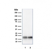 Western blot testing of human 1) JEG-3 and 2) LNCaP lysate with SOD1 antibody. Predicted molecular weight ~16 kDa.